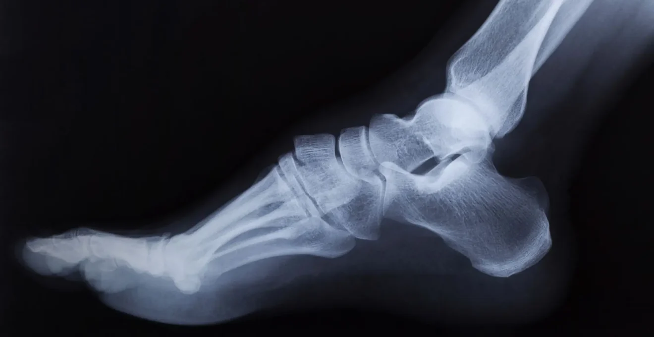 chirurgie du pied à Lyon